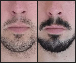 Beard Growth - INS2001 Beard Growth - INS2001